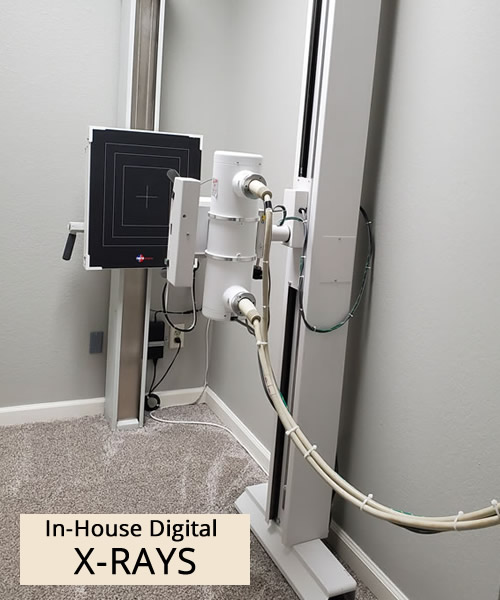 In-house Digital X-Rays in Casper, Wyoming